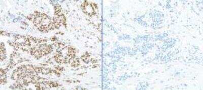 Immunohistochemistry-Paraffin: RPA2 [p Ser4, p Ser8] Antibody [NBP1-23017]